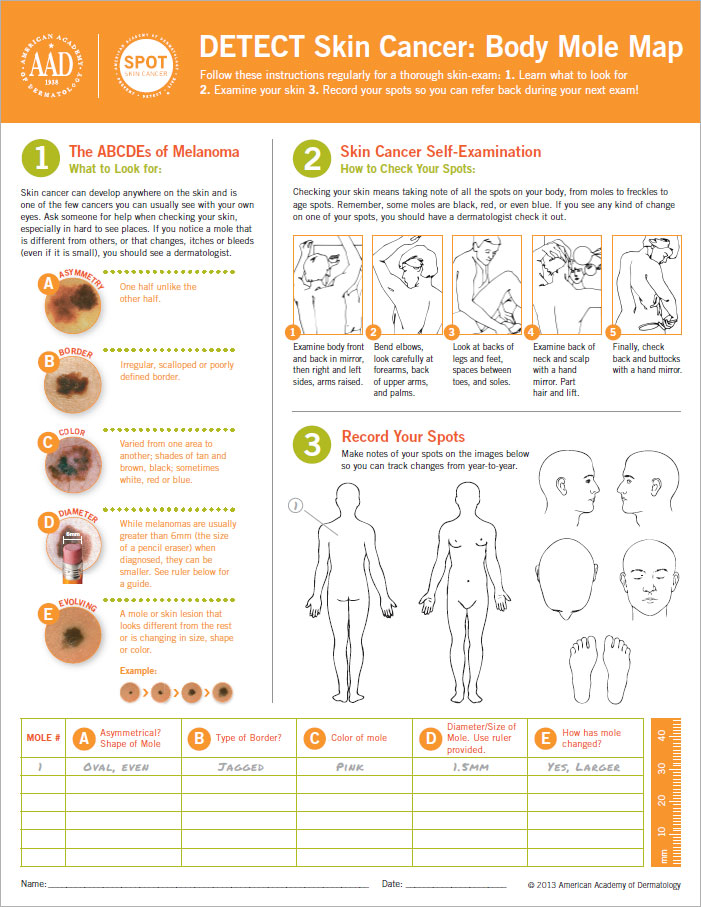 Mole Chart For Skin Cancer