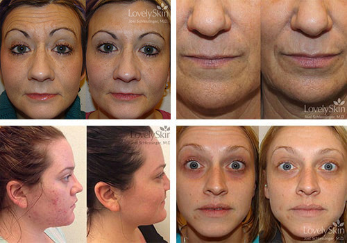 Skin Specialists P.C. Before and After Photos